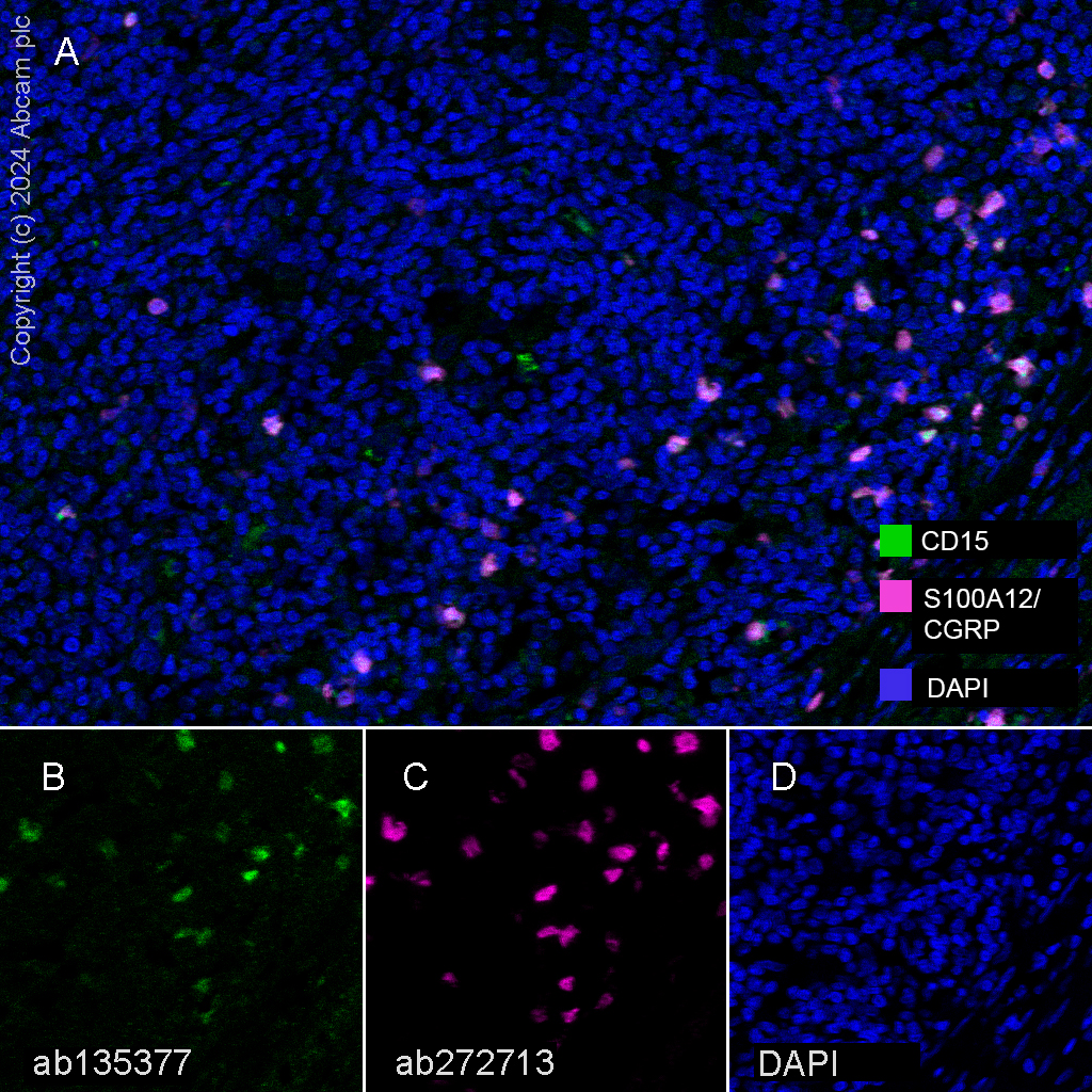 Multiplex immunohistochemistry - Anti-S100A12/CGRP antibody [EPR23677-111] - BSA and Azide free (ab273051), expandable thumbnail