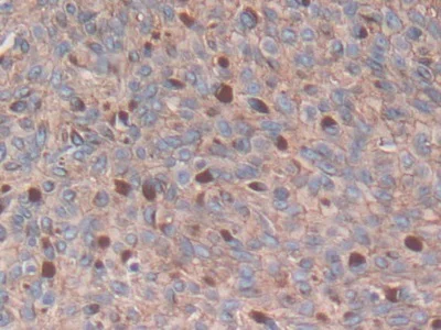 Immunohistochemistry (Formalin/PFA-fixed paraffin-embedded sections) - Anti-S100A14 antibody (AB233189)