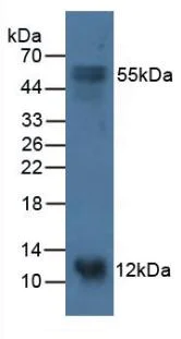 Western blot - Anti-S100A14 antibody (AB233189)