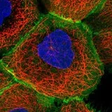 Immunocytochemistry/ Immunofluorescence - Anti-S100A16 antibody (AB130419)
