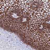 Immunohistochemistry (Formalin/PFA-fixed paraffin-embedded sections) - Anti-S100A16 antibody (AB130419)