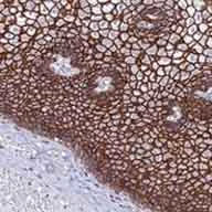 Immunohistochemistry (Formalin/PFA-fixed paraffin-embedded sections) - Anti-S100A16 antibody (AB130419)