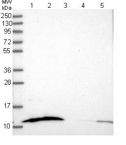 Western blot - Anti-S100A16 antibody (AB130419)