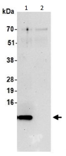 Immunoprecipitation - Anti-S100A16 antibody (AB240572), expandable thumbnail