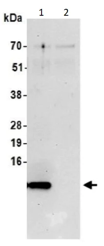 Immunoprecipitation - Anti-S100A16 antibody (AB240572)