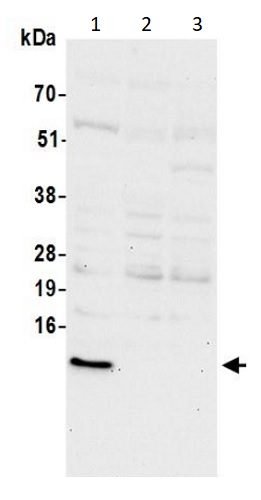 Western blot - Anti-S100A16 antibody (AB240572), expandable thumbnail