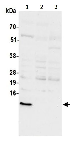 Western blot - Anti-S100A16 antibody (AB240572)