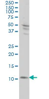 Western blot - Anti-S100A4 antibody [1F12-1G7] (AB93283)