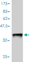 Western blot - Anti-S100A4 antibody [1F12-1G7] (AB93283)