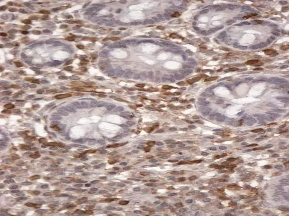 Immunohistochemistry (Formalin/PFA-fixed paraffin-embedded sections) - Anti-S100A4 antibody (AB58597)