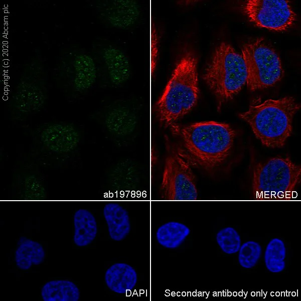 Immunocytochemistry/ Immunofluorescence - Anti-S100A4 antibody [EPR14639(2)] (AB197896)