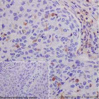 Immunohistochemistry (Formalin/PFA-fixed paraffin-embedded sections) - Anti-S100A4 antibody [EPR14639(2)] (AB197896)