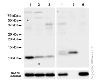 Western blot - Anti-S100A4 antibody [EPR14639(2)] (AB197896)