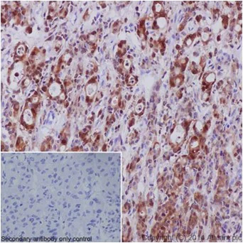 Immunohistochemistry (Formalin/PFA-fixed paraffin-embedded sections) - Anti-S100A4 antibody [EPR14639(2)] - BSA and Azide free (AB220213)