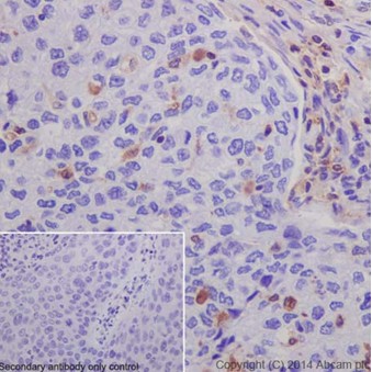 Immunohistochemistry (Formalin/PFA-fixed paraffin-embedded sections) - Anti-S100A4 antibody [EPR14639(2)] - BSA and Azide free (ab220213), expandable thumbnail