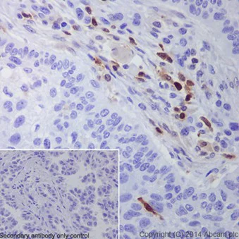 Immunohistochemistry (Formalin/PFA-fixed paraffin-embedded sections) - Anti-S100A4 antibody [EPR14639(2)] - BSA and Azide free (AB220213)