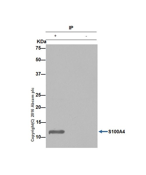 Immunoprecipitation - Anti-S100A4 antibody [EPR14639(2)] - BSA and Azide free (AB220213), expandable thumbnail