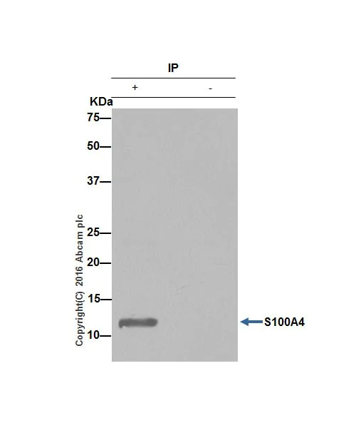 Immunoprecipitation - Anti-S100A4 antibody [EPR14639(2)] - BSA and Azide free (AB220213)