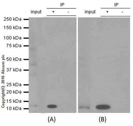 Immunoprecipitation - Anti-S100A4 antibody [EPR14639(2)] - BSA and Azide free (AB220213), expandable thumbnail