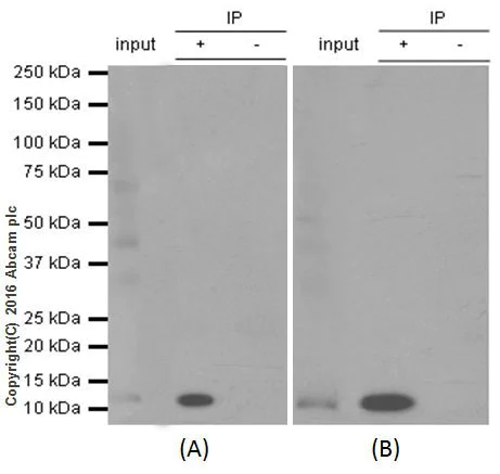 Immunoprecipitation - Anti-S100A4 antibody [EPR14639(2)] - BSA and Azide free (AB220213)