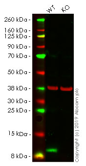 Western blot - Anti-S100A4 antibody [EPR14639(2)] - BSA and Azide free (AB220213), expandable thumbnail