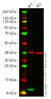 Western blot - Anti-S100A4 antibody [EPR14639(2)] - BSA and Azide free (AB220213)