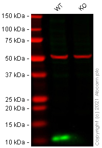 Western blot - Anti-S100A4 antibody [EPR14639(2)] - BSA and Azide free (AB220213), expandable thumbnail