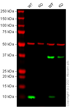 Western blot - Anti-S100A4 antibody [EPR14639(2)] - BSA and Azide free (AB220213), expandable thumbnail
