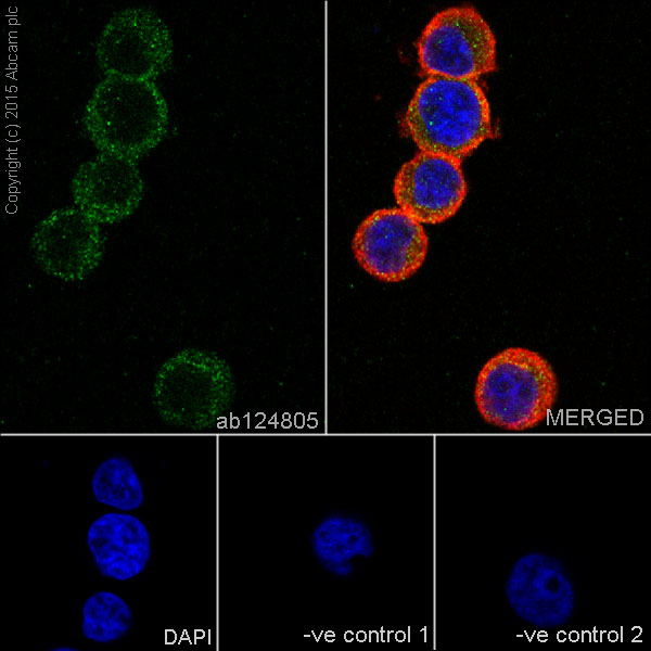 Immunocytochemistry/ Immunofluorescence - Anti-S100A4 antibody [EPR2761(2)] (ab124805), expandable thumbnail