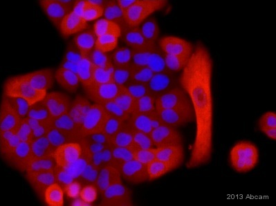Immunocytochemistry/ Immunofluorescence - Anti-S100A4 antibody [EPR2761(2)] (AB124805), expandable thumbnail