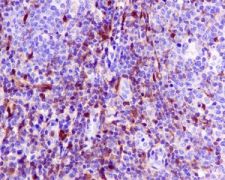 Immunohistochemistry (Formalin/PFA-fixed paraffin-embedded sections) - Anti-S100A4 antibody [EPR2761(2)] (ab124805), expandable thumbnail