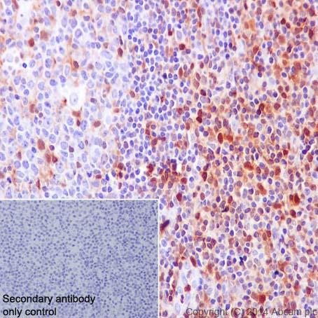 Immunohistochemistry (Formalin/PFA-fixed paraffin-embedded sections) - Anti-S100A4 antibody [EPR2761(2)] (ab124805), expandable thumbnail
