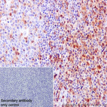Immunohistochemistry (Formalin/PFA-fixed paraffin-embedded sections) - Anti-S100A4 antibody [EPR2761(2)] (AB124805)