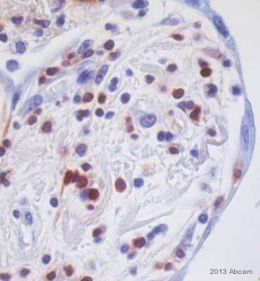 Immunohistochemistry (Formalin/PFA-fixed paraffin-embedded sections) - Anti-S100A4 antibody [EPR2761(2)] (AB124805), expandable thumbnail
