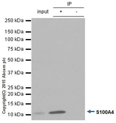 Immunoprecipitation - Anti-S100A4 antibody [EPR2761(2)] (AB124805), expandable thumbnail