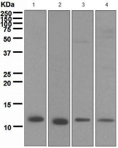 Western blot - Anti-S100A4 antibody [EPR2761(2)] (ab124805), expandable thumbnail