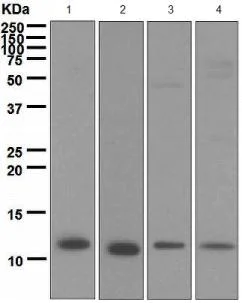 Western blot - Anti-S100A4 antibody [EPR2761(2)] (AB124805)