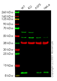 Western blot - Anti-S100A4 antibody [EPR2761(2)] (AB124805), expandable thumbnail