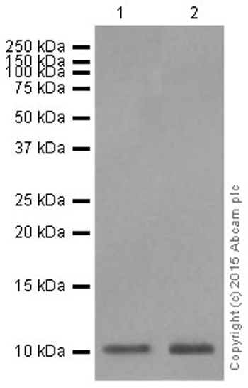 Western blot - Anti-S100A4 antibody [EPR2761(2)] (ab124805), expandable thumbnail