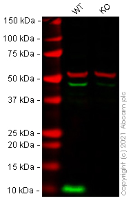Western blot - Anti-S100A4 antibody [EPR2761(2)] (AB124805), expandable thumbnail