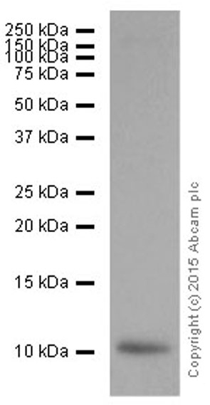 Western blot - Anti-S100A4 antibody [EPR2761(2)] (ab124805), expandable thumbnail