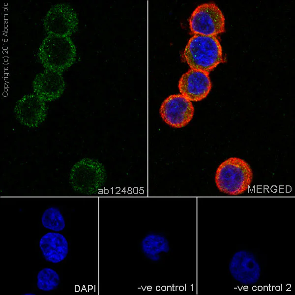 Immunocytochemistry/ Immunofluorescence - Anti-S100A4 antibody [EPR2761(2)] - BSA and Azide free (AB216003)