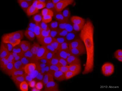 Immunocytochemistry/ Immunofluorescence - Anti-S100A4 antibody [EPR2761(2)] - BSA and Azide free (AB216003)