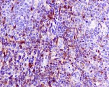 Immunohistochemistry (Formalin/PFA-fixed paraffin-embedded sections) - Anti-S100A4 antibody [EPR2761(2)] - BSA and Azide free (AB216003)