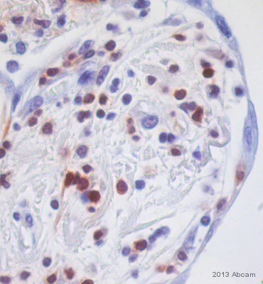 Immunohistochemistry (Formalin/PFA-fixed paraffin-embedded sections) - Anti-S100A4 antibody [EPR2761(2)] - BSA and Azide free (AB216003)