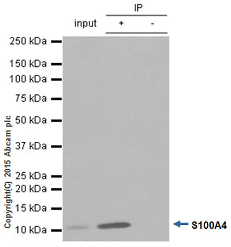 Immunoprecipitation - Anti-S100A4 antibody [EPR2761(2)] - BSA and Azide free (AB216003)