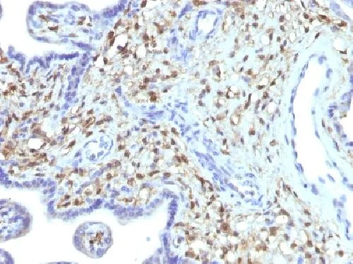 Immunohistochemistry (Formalin/PFA-fixed paraffin-embedded sections) - Anti-S100A4 antibody [S100A4/1481] (AB218511)