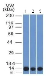 Western blot - Anti-S100A4 antibody [S100A4/1481] (AB218511)