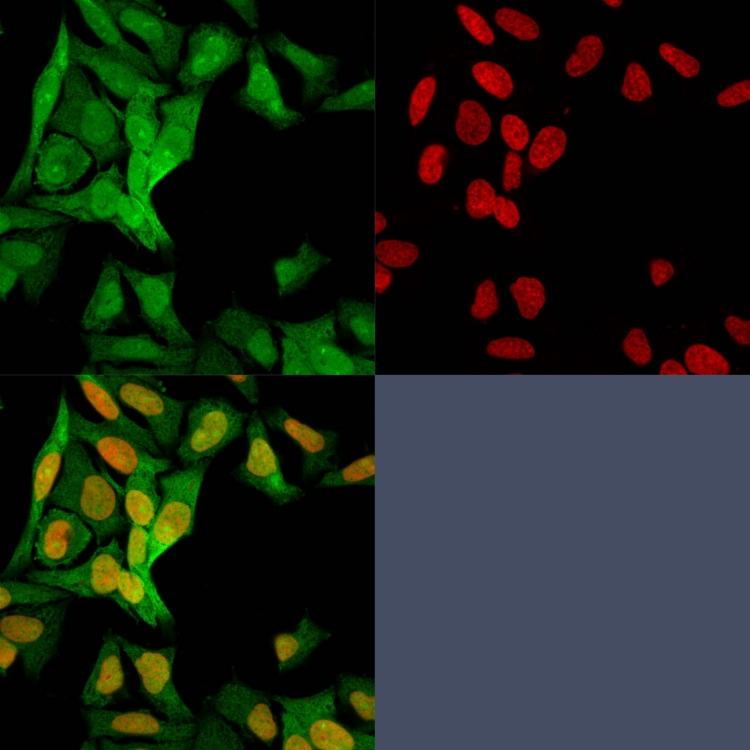 Immunocytochemistry - Anti-S100A4 antibody [S100A4/1482] (AB218512), expandable thumbnail