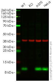 Western blot - Anti-S100A4 antibody [S100A4/1482] (AB218512), expandable thumbnail